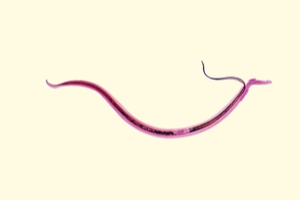 Schistosomiasis klachten, Giardia mens symptomen. Choleretic gyermekek giardiasis